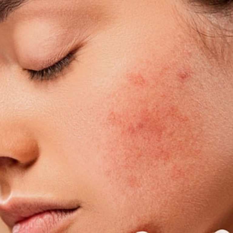 Inside2_StressNSkin